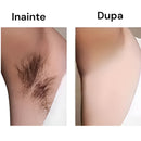 Epilator Electric Reincarcabil pentru Femei - Tehnologie Avansata pentru Epilare Profesionala Acasa