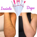 Epilator Facial 3-in-1 pentru Indepartarea Parului Nedorit – Capete Interschimbabile